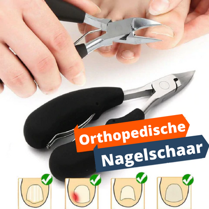 Orthopedische Nagelschaar - Nagelsax